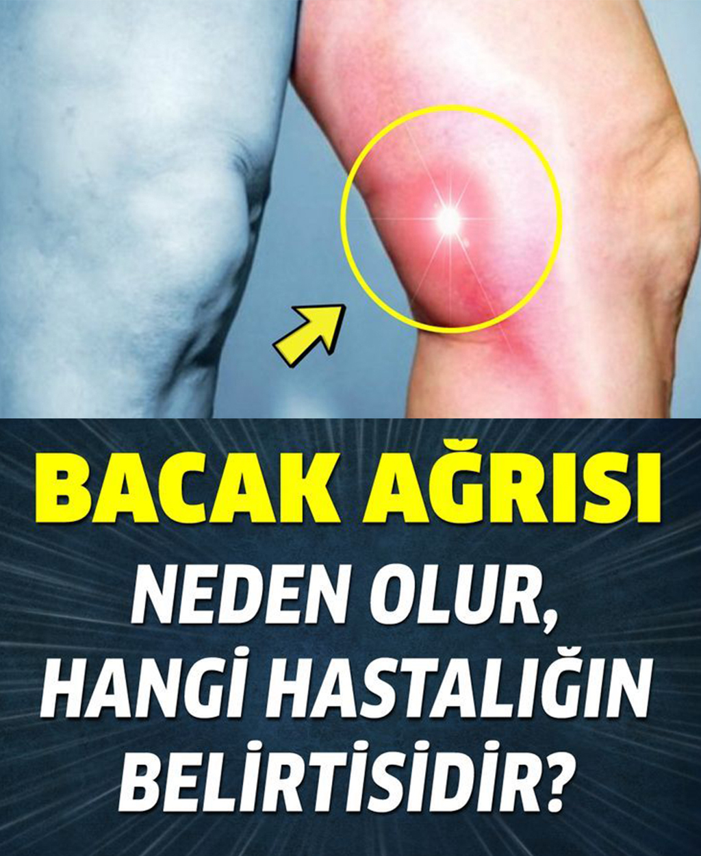 Bacak ağrısı neden olur, neyin belirtisi? - 1