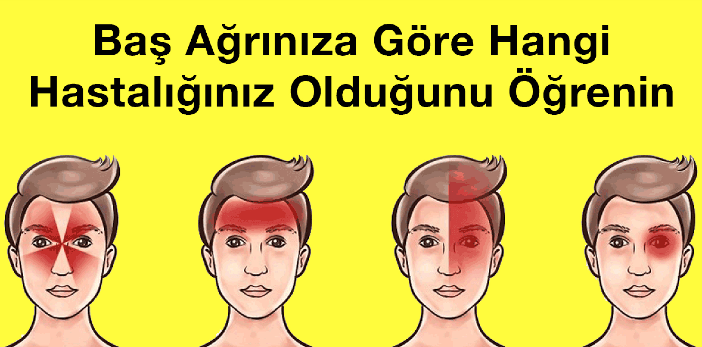 Baş Ağrınıza Göre Hangi Hastalığınız Olduğunu Öğrenin - 2