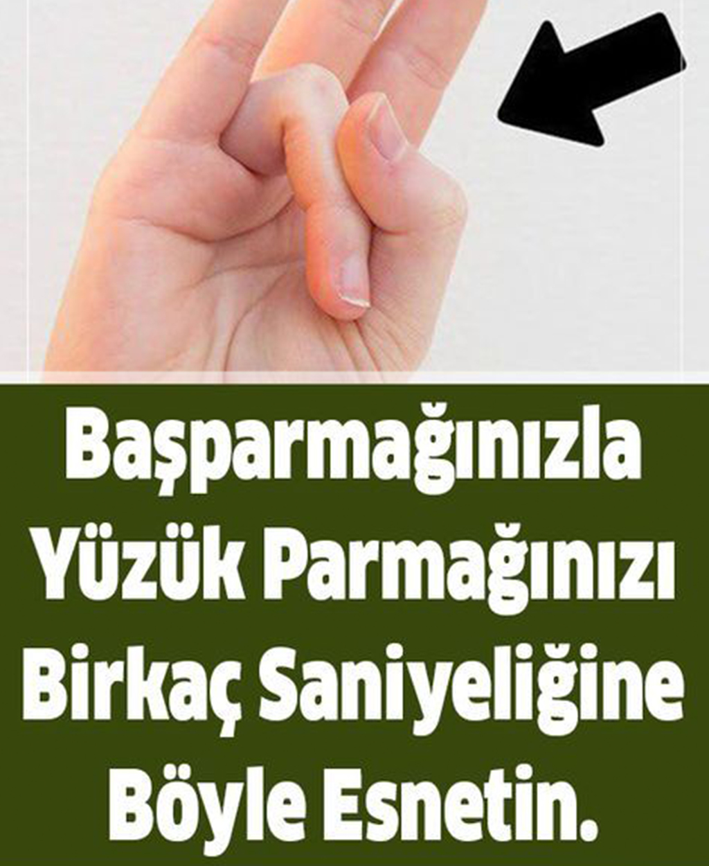 Başparmağınızla Yüzük Parmağınızı Birkaç Saniyeliğine Böyle Esnetin - 1