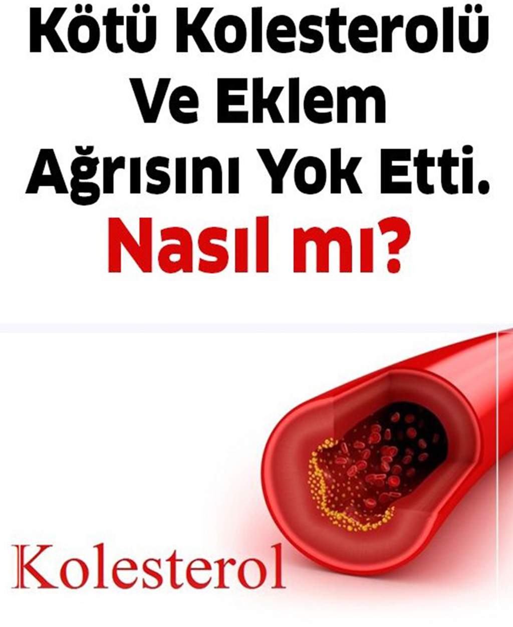 Kötü Kolesterolü ve Eklem Ağrısını Yok Etti - 1