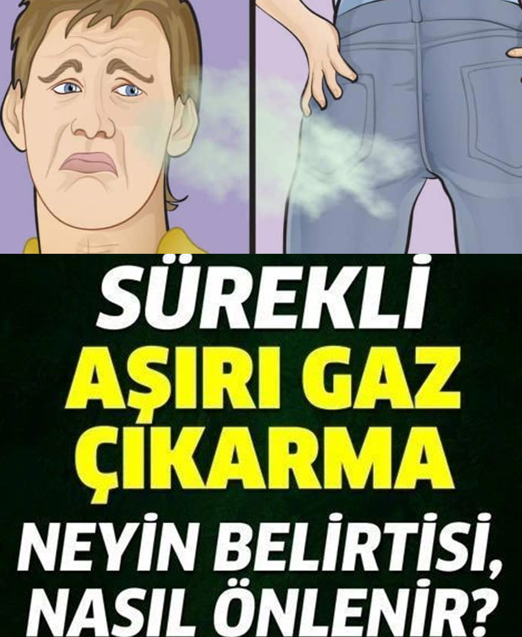 Sürekli gaz çıkarmak neyin belirtisidir? - 1