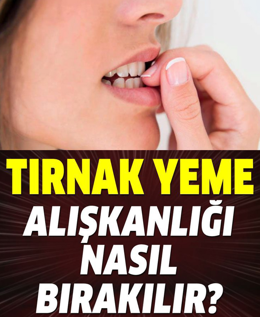 Tırnak yeme alışkanlığı nasıl bırakılır? - 1